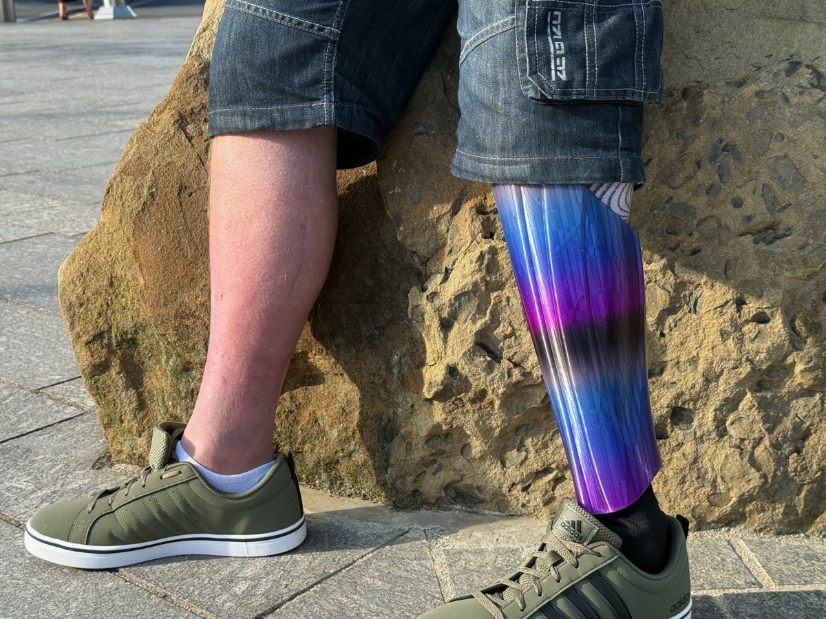 A StyleLimb cover worn on a prosthetic leg