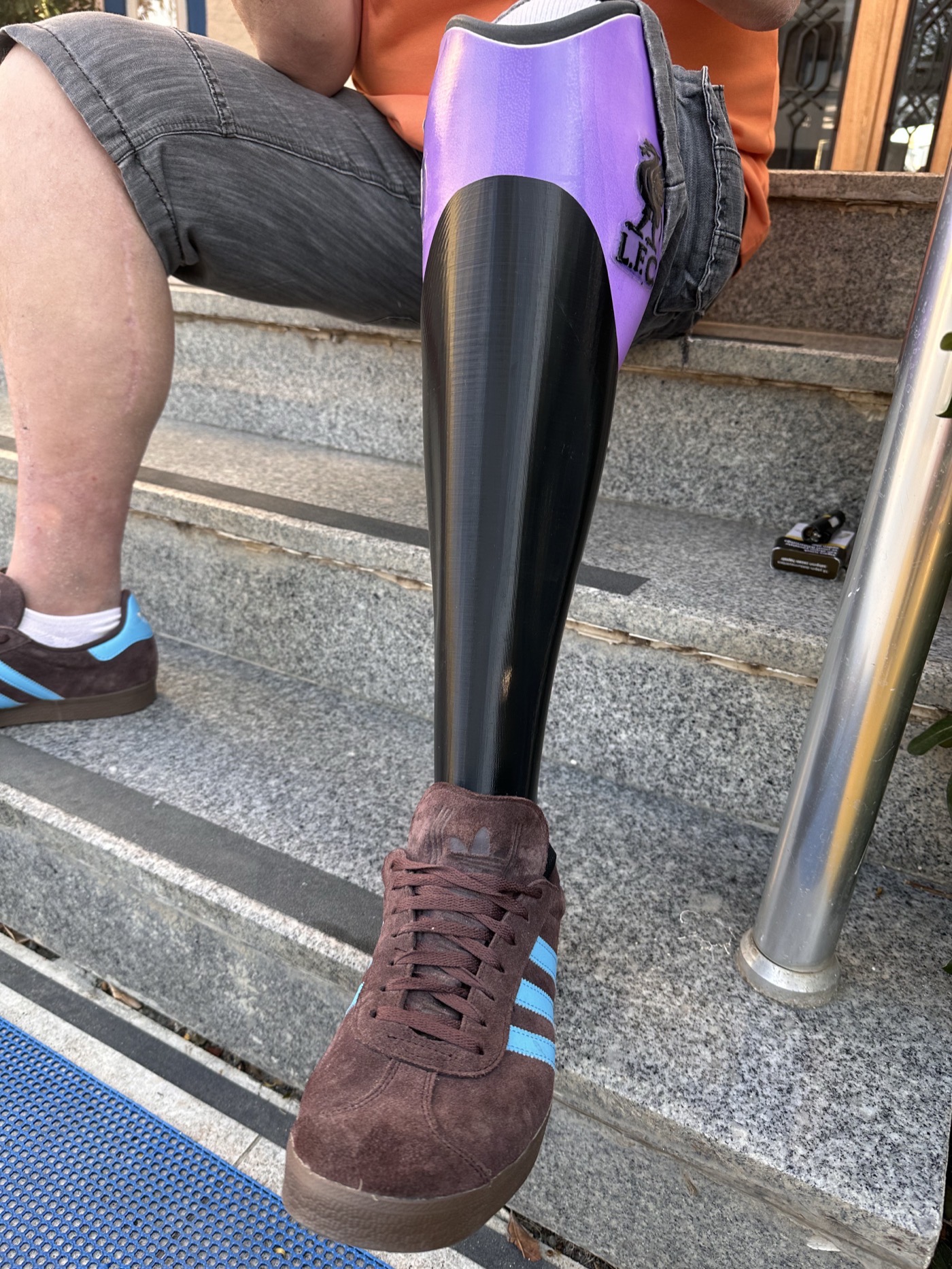 StyleLimb cover worn on a prosthetic leg